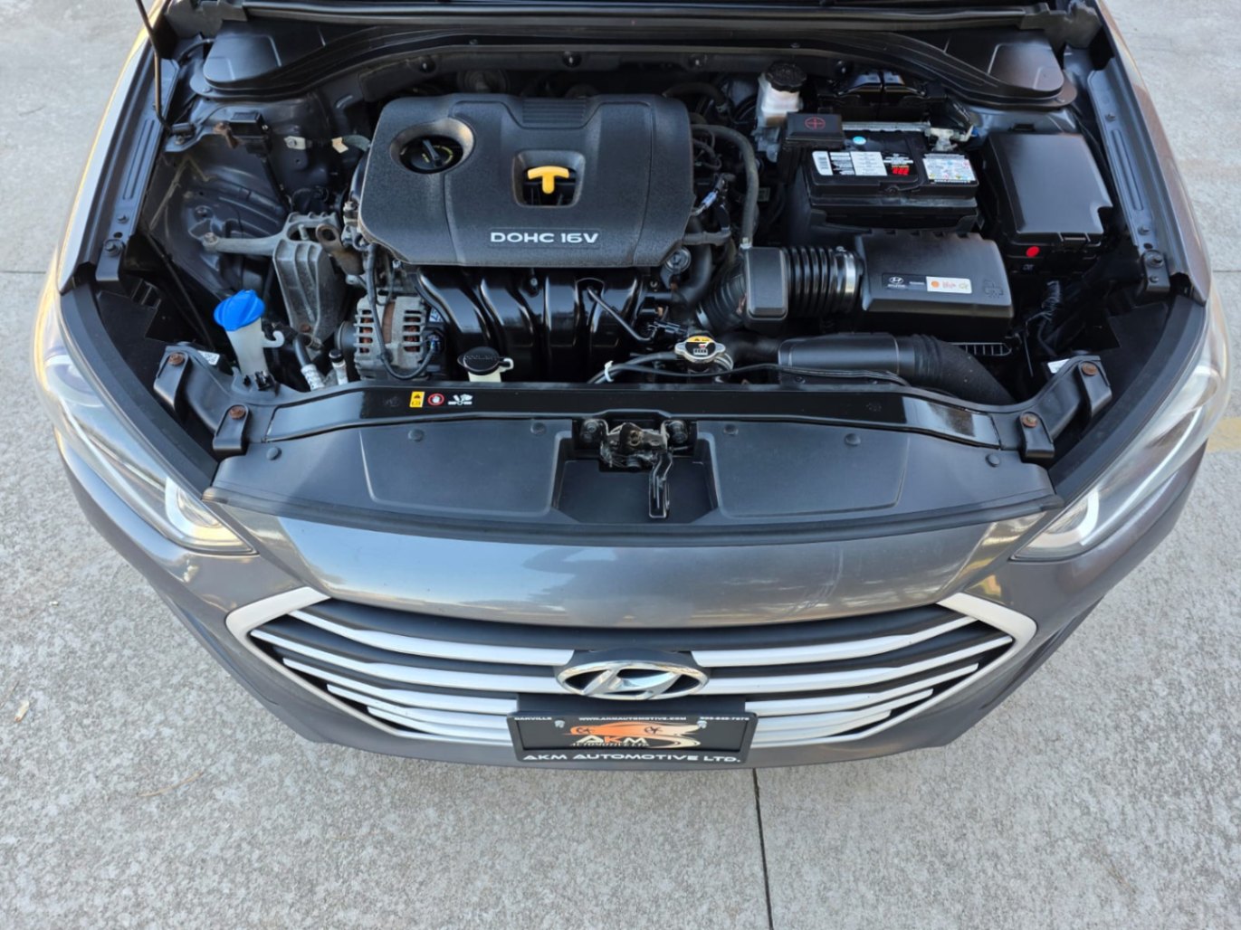 /akmautomotiveltd/2018-Hyundai-Elantra-8044327087361804.jpg